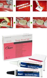 Цемент для временной фиксации