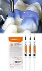 Протравочные гели