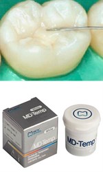 Материалы для временного пломбирования