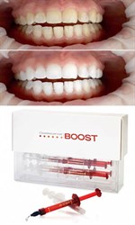 Отбеливание