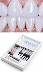 Композитные виниры Componeer