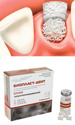 Костный материал