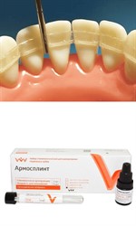 Шинирование зубов